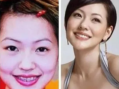 戒原整板是真干吗？震惊！女星背后竟有如此秘密，整容行业潜规则大曝光！